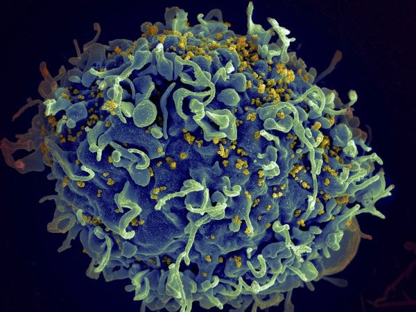 California lab makes new discovery in search for HIV vaccine