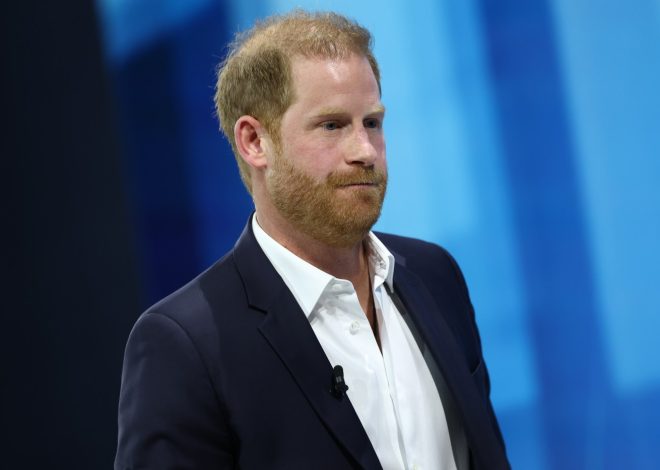 Balding Prince Harry needs a hair transplant ASAP, his boyhood hairdresser says