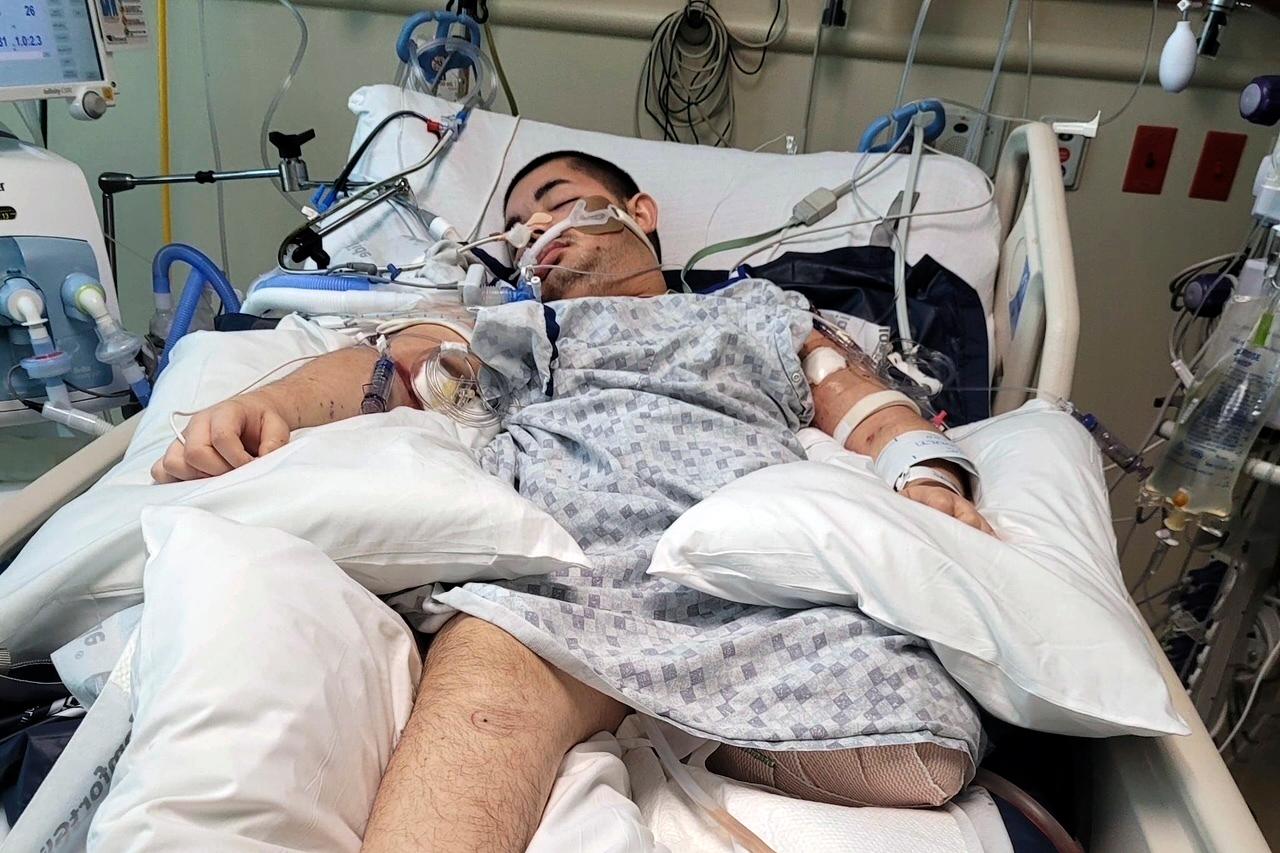 Intellectually disabled teen shot by Idaho police dies after being removed from life support