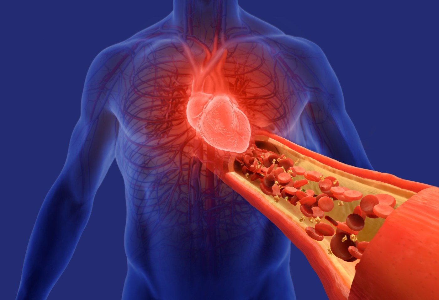 Blood pressure-lowering medication shows promise in new trial results