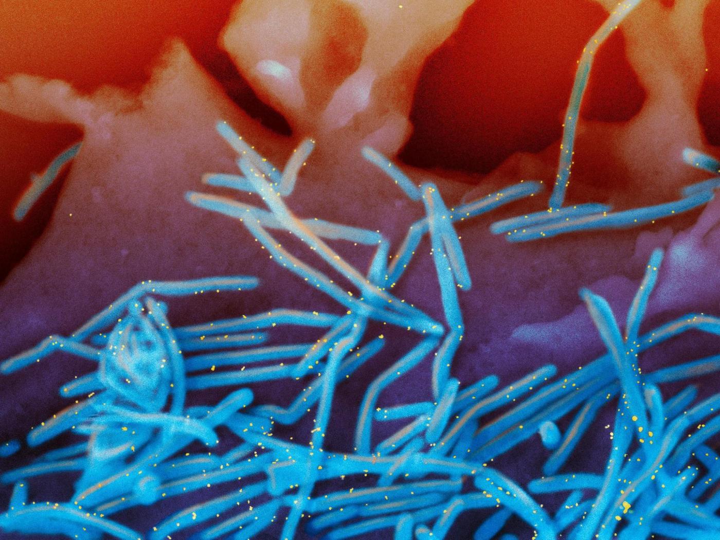 Experts make new recommendations on RSV and meningitis vaccines, but it’s unclear what happens next