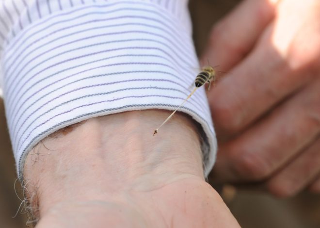 Bay Area plastic surgeon’s novel treatment for bee stings published in medical journal
